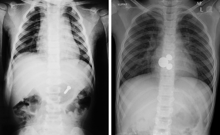 16 откровений от рентгенологов – вот как выглядят разные вещи под всепроникающими лучами