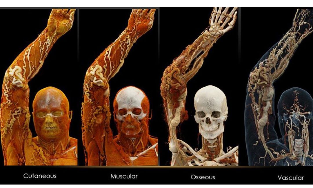 16 откровений от рентгенологов – вот как выглядят разные вещи под всепроникающими лучами